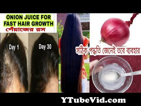 View Full Screen: 100hair growth onion juice and coconut oil no hairfall.jpg