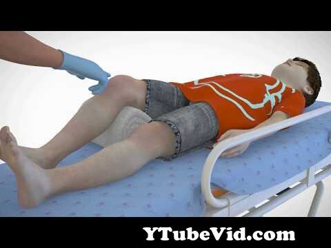 View Full Screen: nio pediatric intraosseous device.mp4